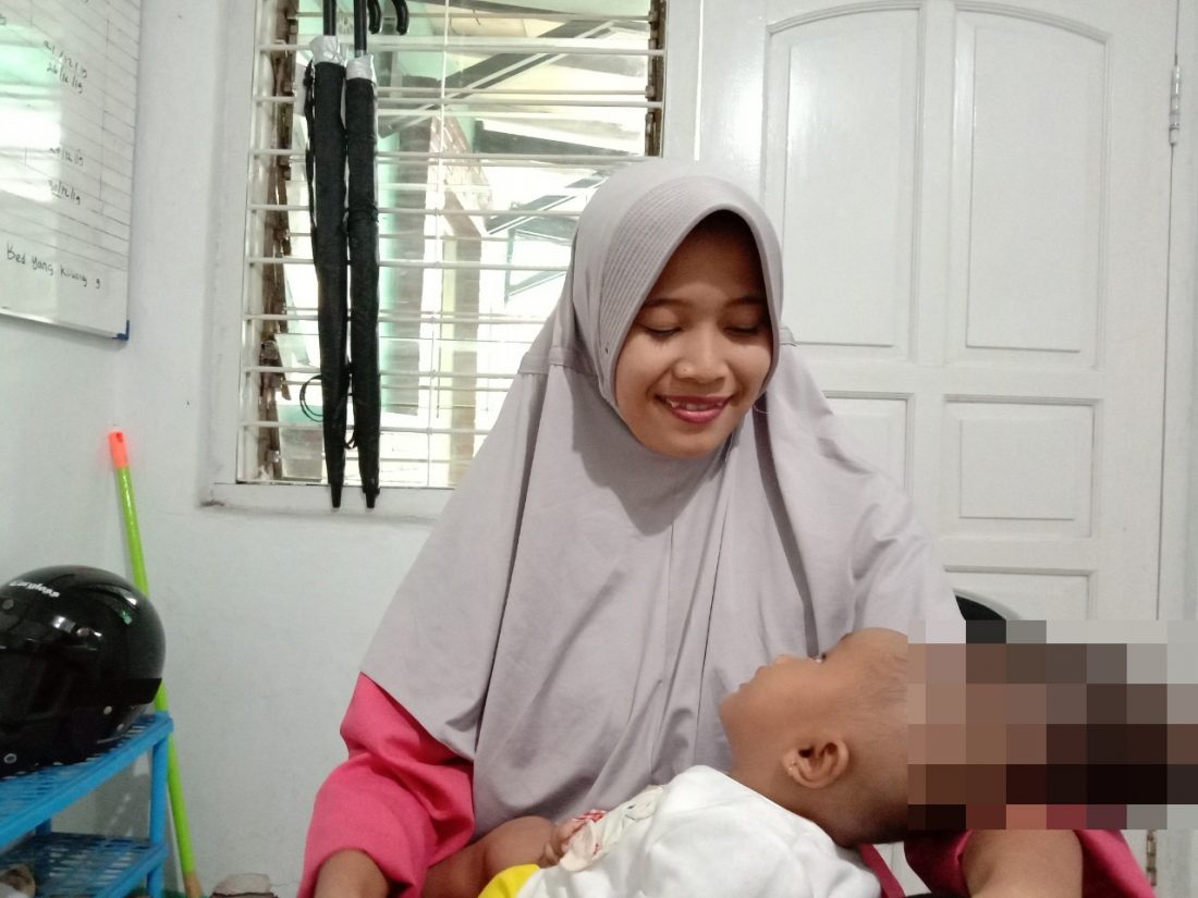 Ainun kecil menderita Ensephalocele Unspesific