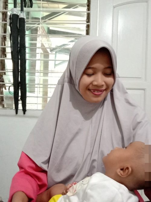 Ainun kecil menderita Ensephalocele Unspesific