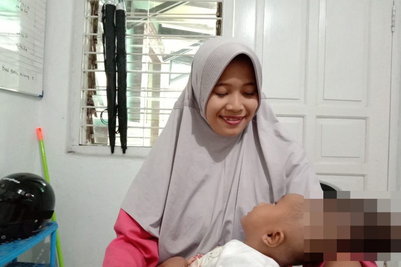 Ainun kecil menderita Ensephalocele Unspesific