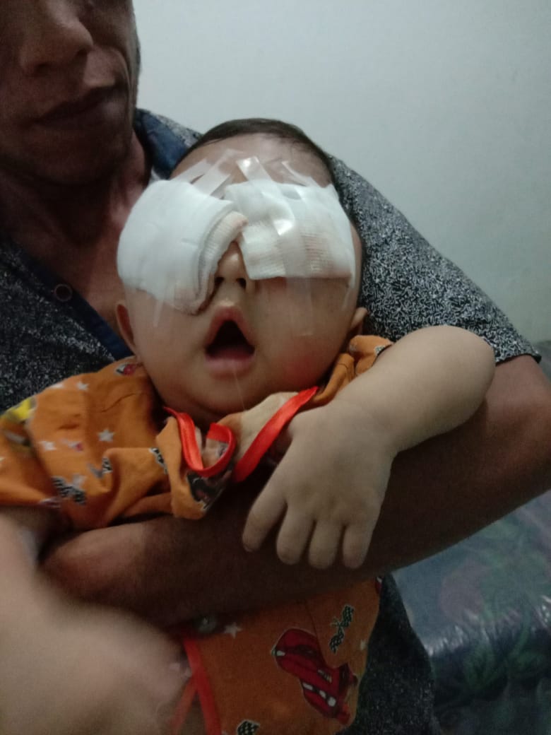 Posprocedural mata