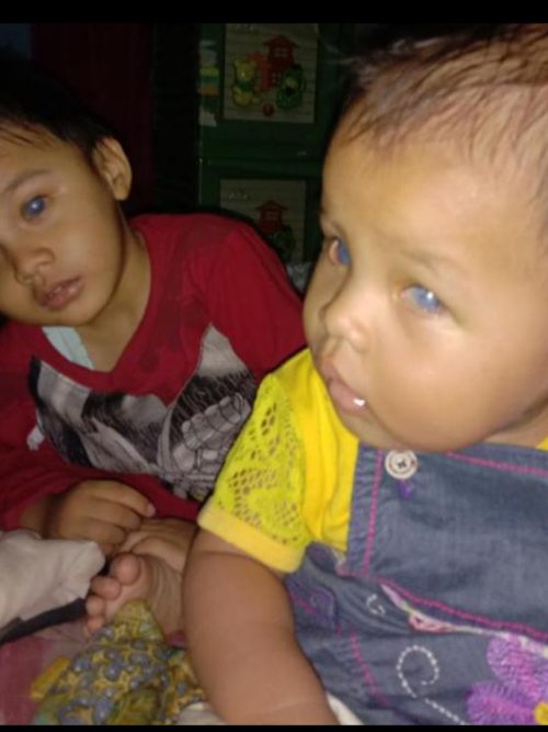 Dedi dan kedua anaknya penderita Glukoma