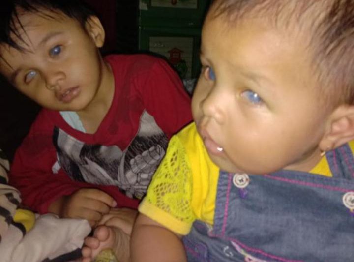 Dedi dan kedua anaknya penderita Glukoma