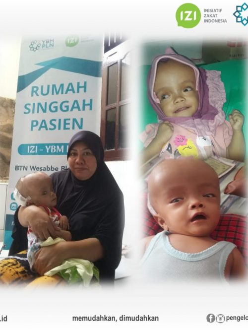 Azizah Hydrocephalus