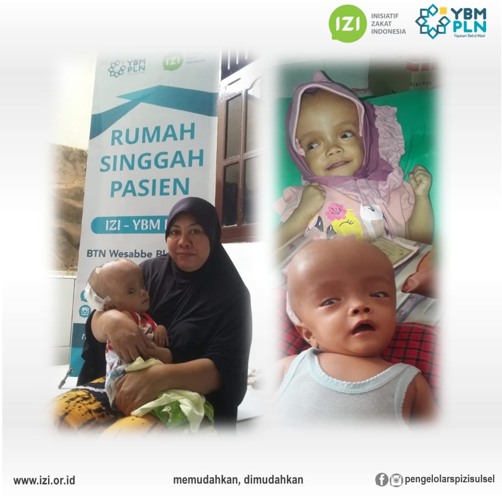Azizah Hydrocephalus