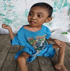 Daffa Polio
