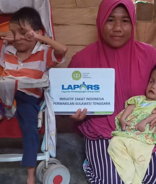 penyintas hidrosefalus dan gizi buruk