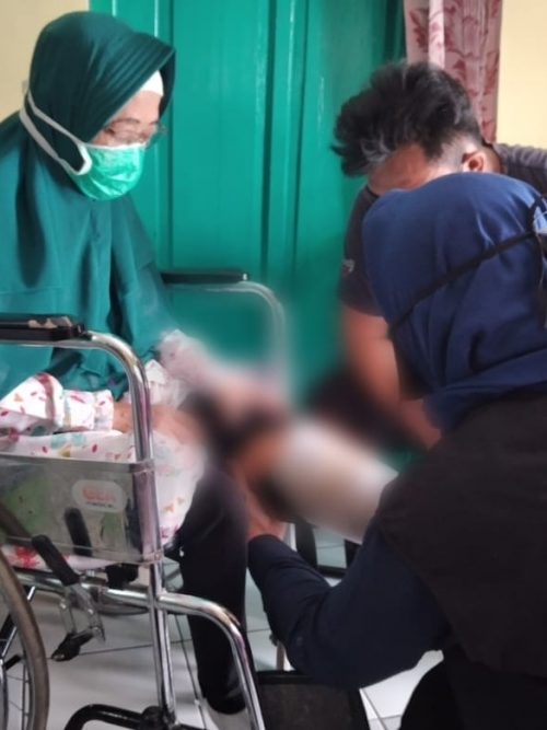 IZI Gotong Royong Berikan Kaki Palsu untuk Difabel