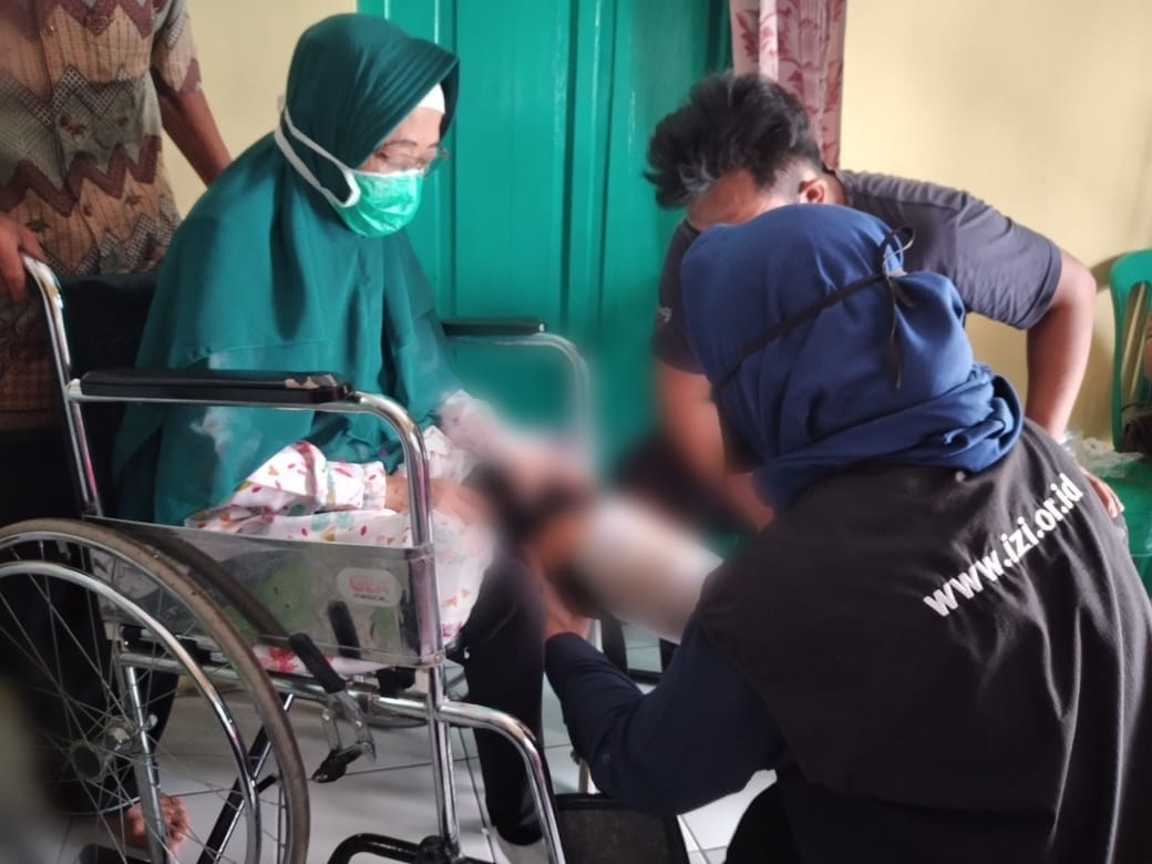 IZI Gotong Royong Berikan Kaki Palsu untuk Difabel